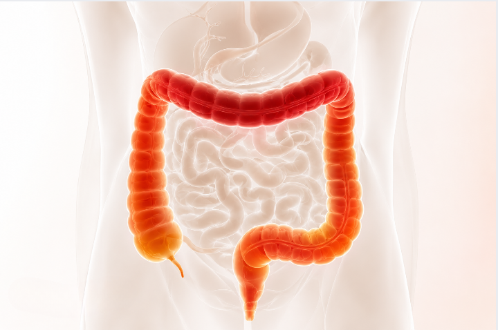 ct virtual colonoscopy