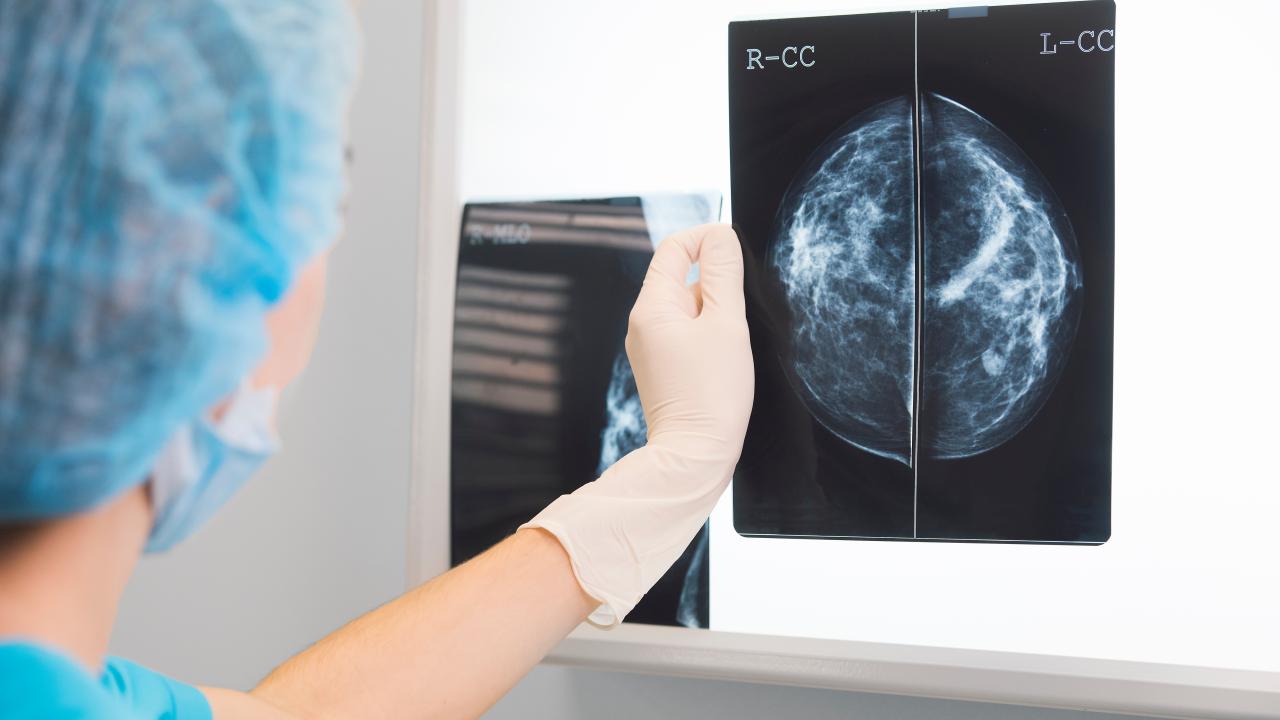 Mammography service