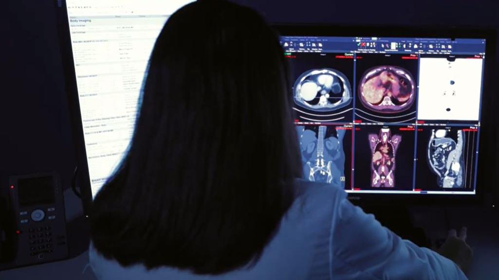 PET/MRI 