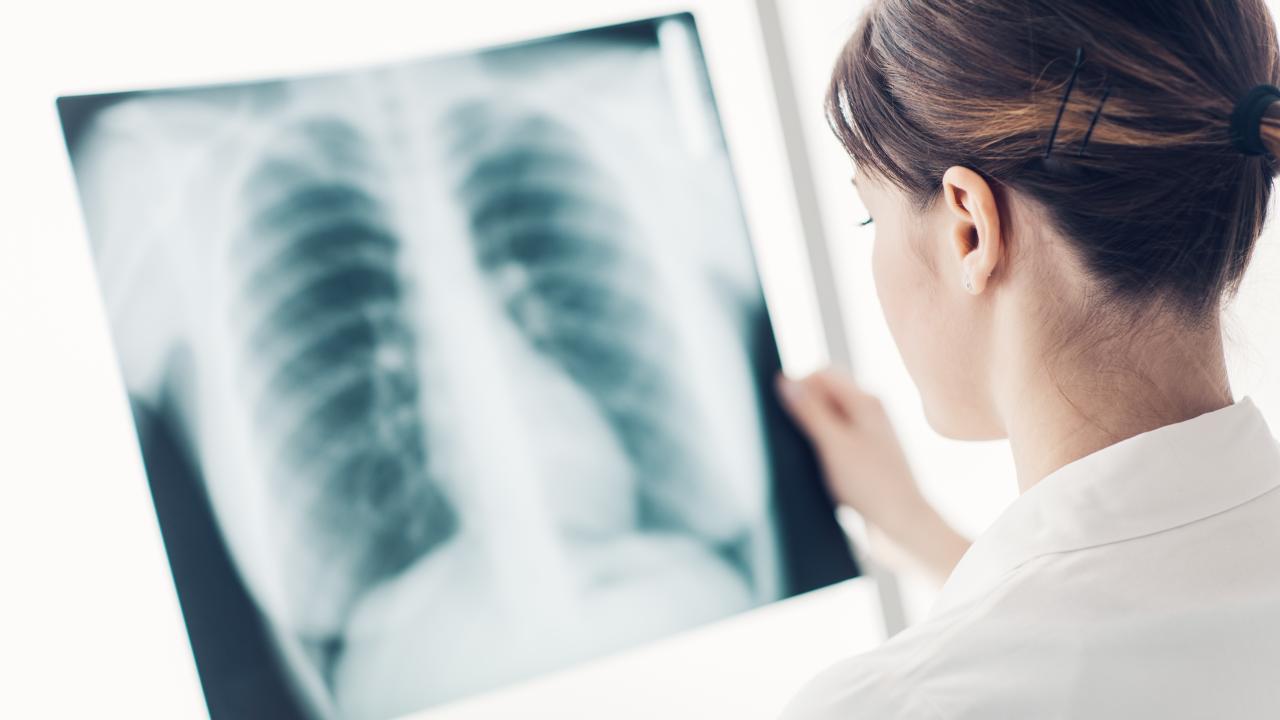 X-Ray services