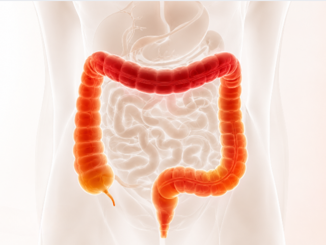 ct virtual colonoscopy