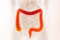 ct virtual colonoscopy